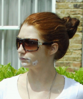 Nicola_Leaving_The_House_With_Cream_On_Her_Spots_180505_3.jpg